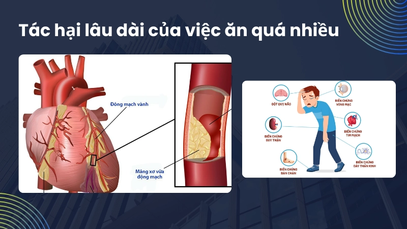 Biến chứng nguy hiểm đối với tim mạch khi dung nạp đường cao